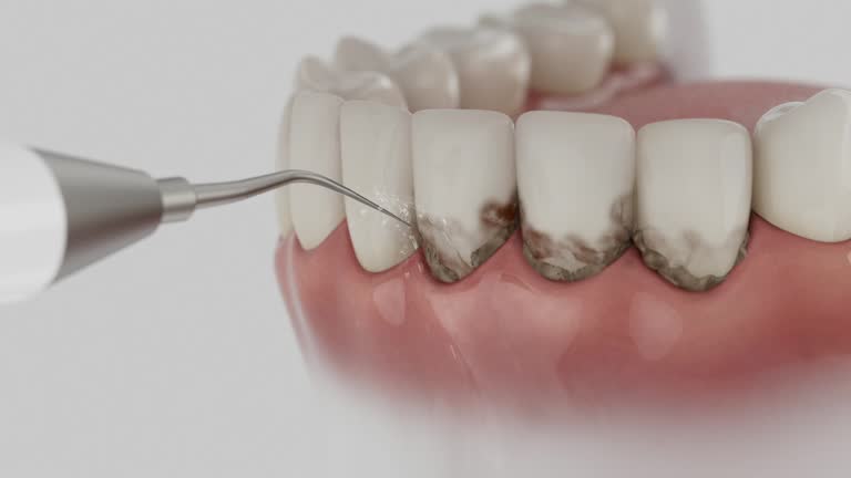 Trusted Dental Implants service in McNair, VA - Dentist Open Now